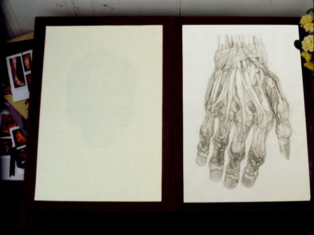 An Anatomy of Melancholy, Jo Ann Kaplan